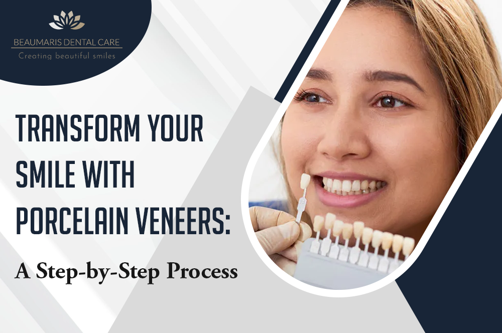 Transform Your Smile with Porcelain Veneers A StepbyStep Process