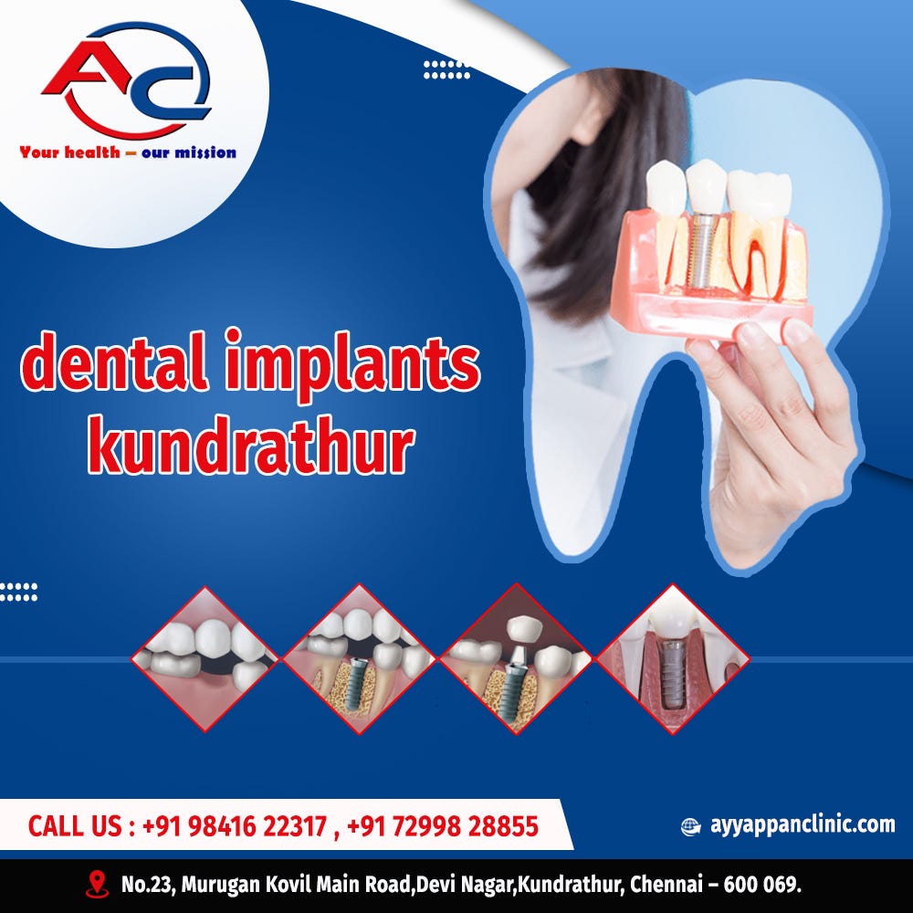 How Do Dental Implants Perform!. Dental implants are surgically