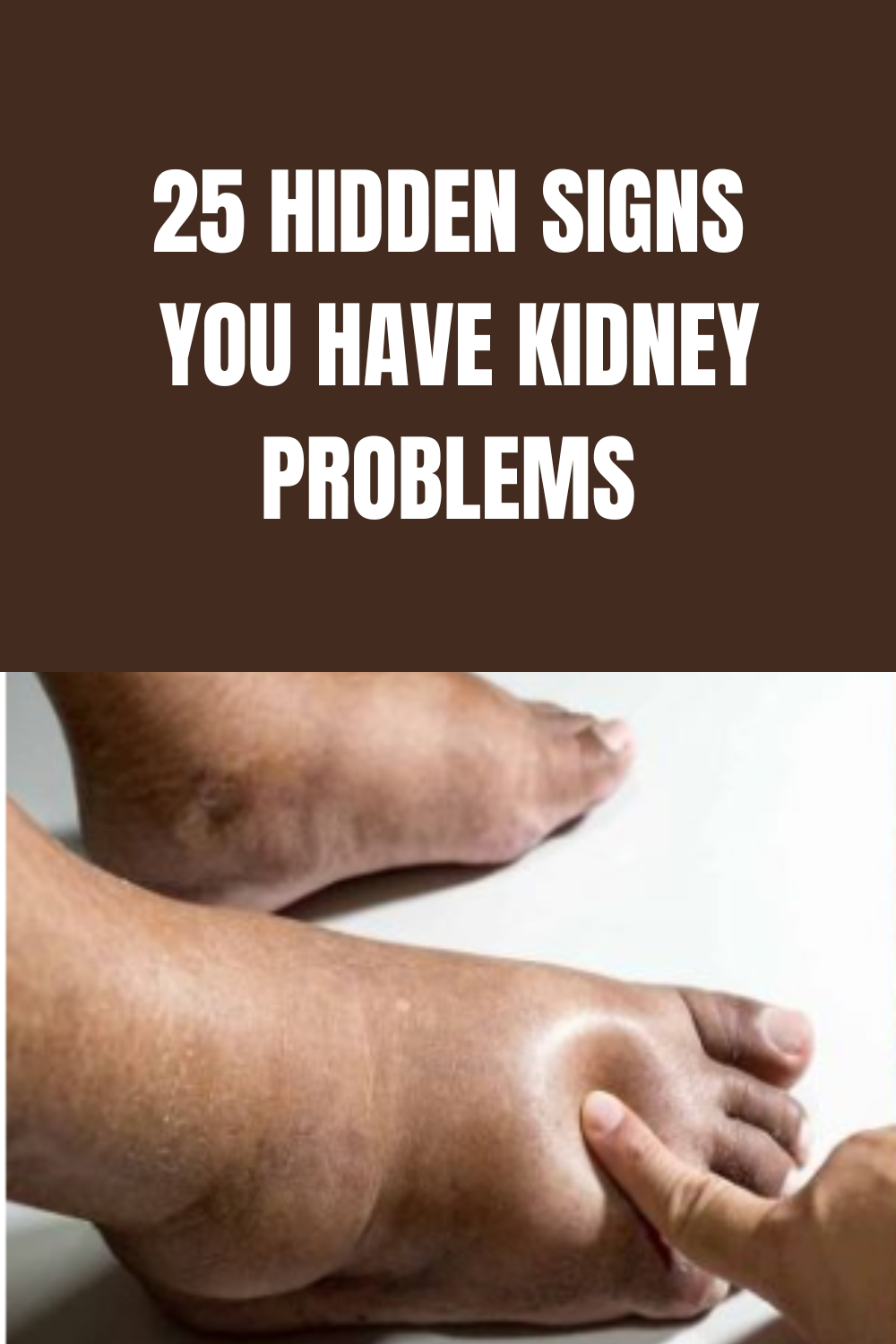25 Hidden Signs You Have Kidney Problems Paula Medium