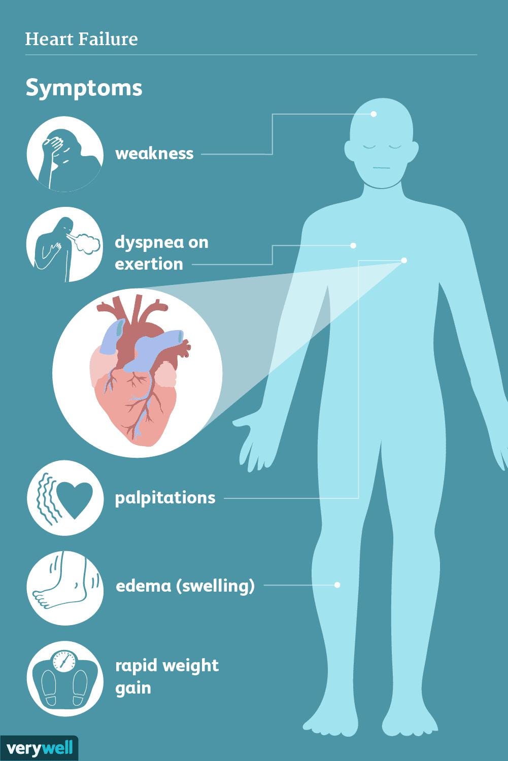 What is BNP and NT-proBNP, and what role they play in heart failure ...