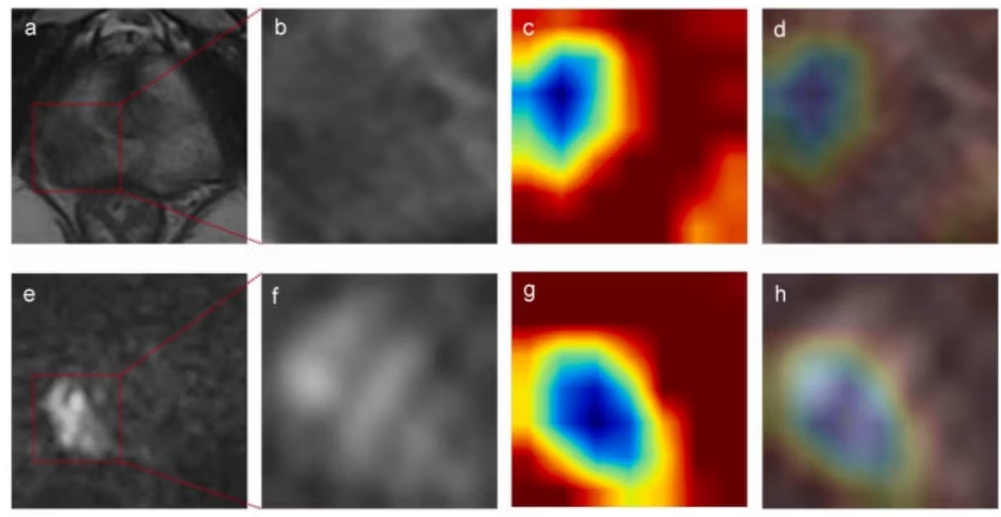 Your MRI & PET Scans Knows More Than Your Doctor Can See — If You Know How to Ask It