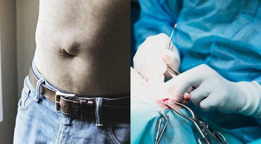 what-does-hernia-pain-feel-like-hernias-occur-when-internal-organs-or
