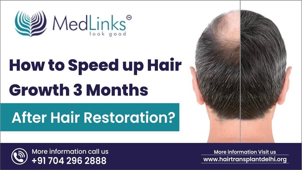 How to Speed up Hair Growth 3 Months after Hair Restoration? by