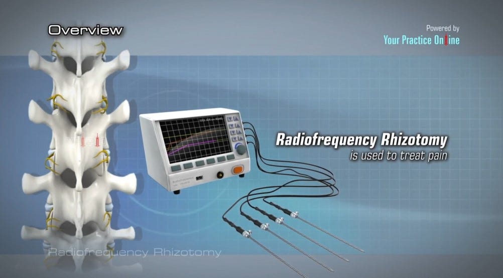 Facet Rhizotomy Patient9 Medium