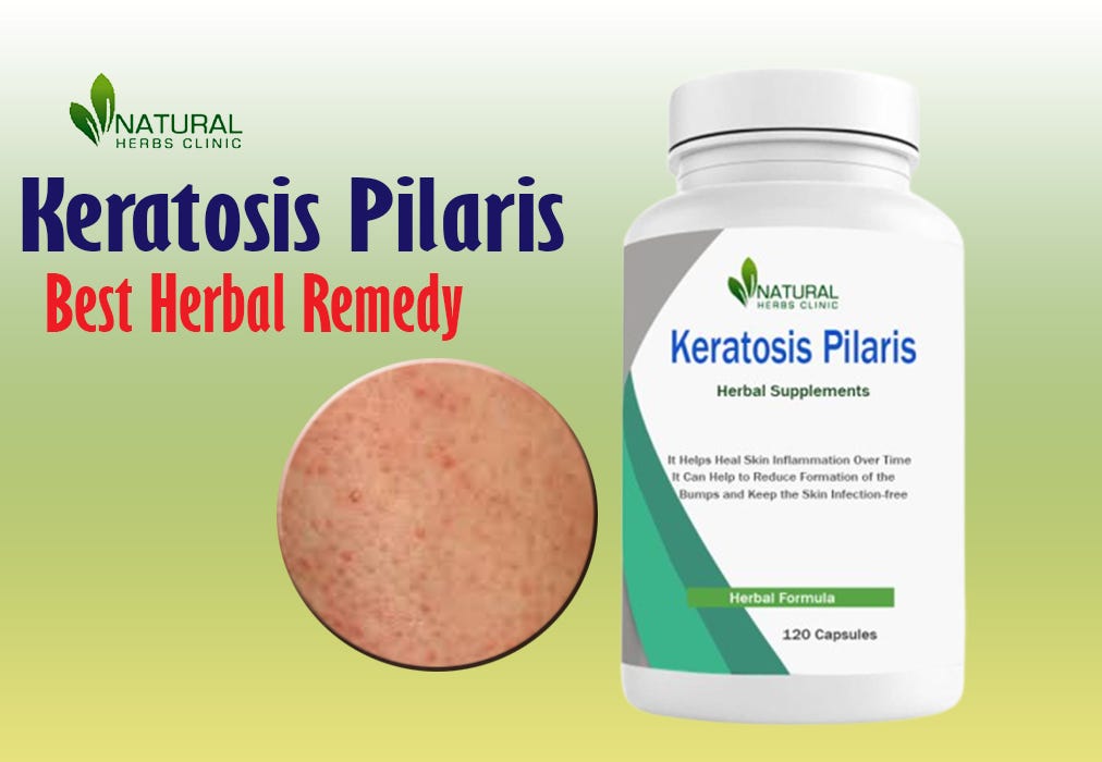 Natural Treatment for Keratosis Pilaris Unveiling the Power of Cod