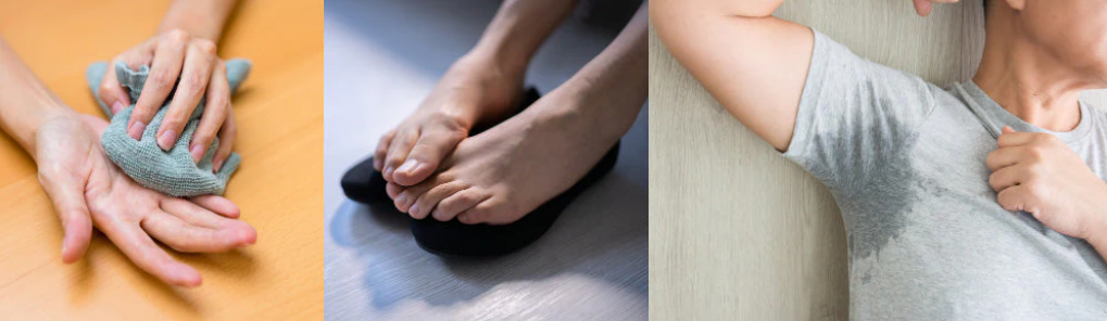 Excessive sweating of the hands, feet, and underarms. Which of these do you experience?