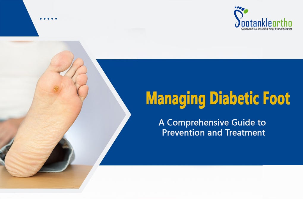 Managing Diabetic Foot A Comprehensive Guide to Prevention and