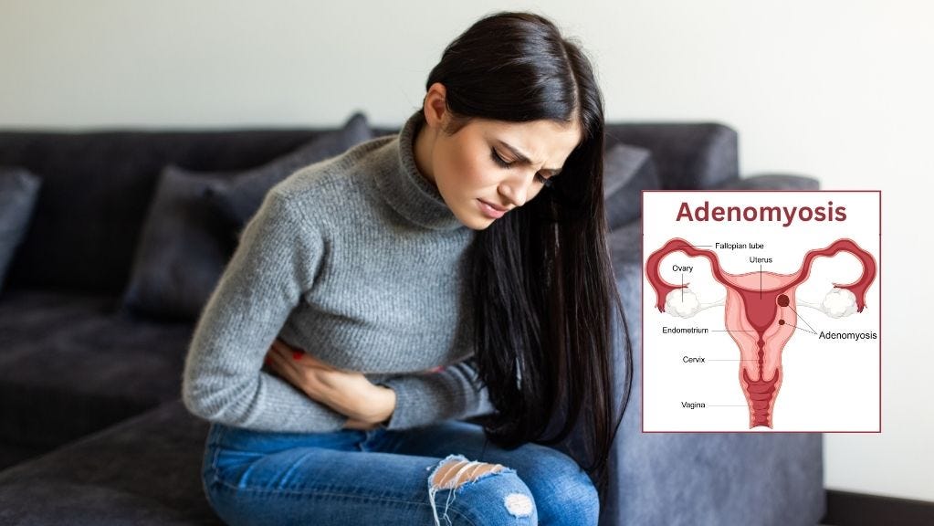 Adenomyosis Understanding a Complex Uterine Condition by Gaudium IVF