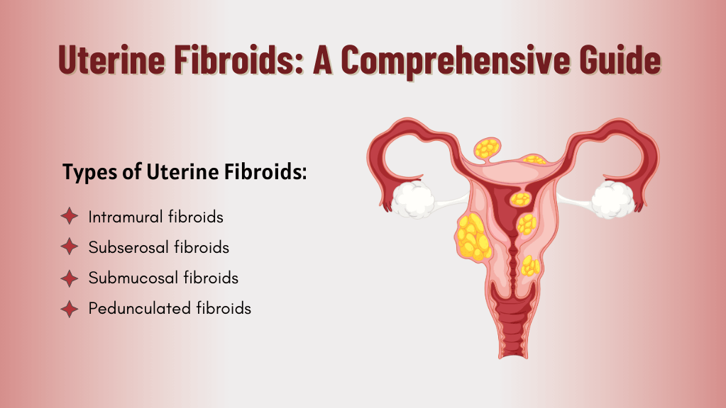 Uterine Fibroids A Comprehensive Guide By Gaudium Ivf Jan 2024 Medium 5589