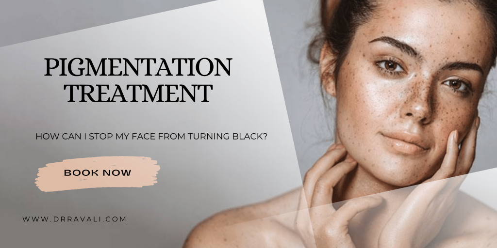 How Can I Stop My Face From Turning Black? by Drravali Sep, 2023