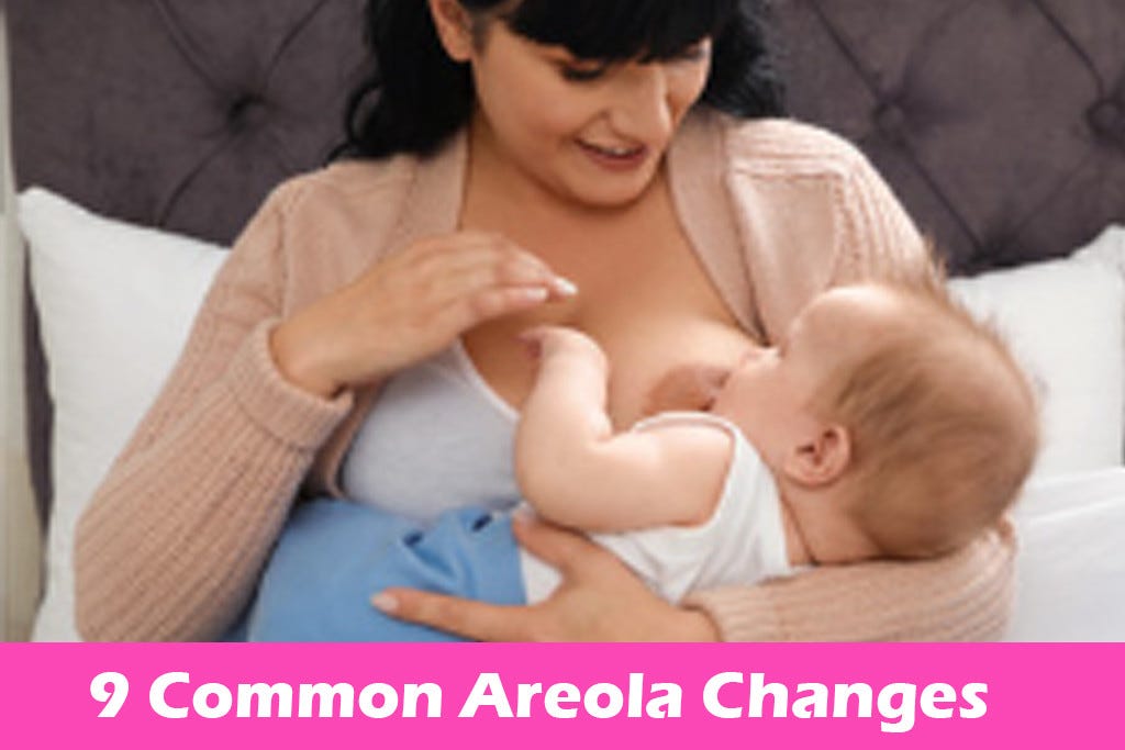 Areola — 9 Common Changes That Doesn't Mean You're Pregnant