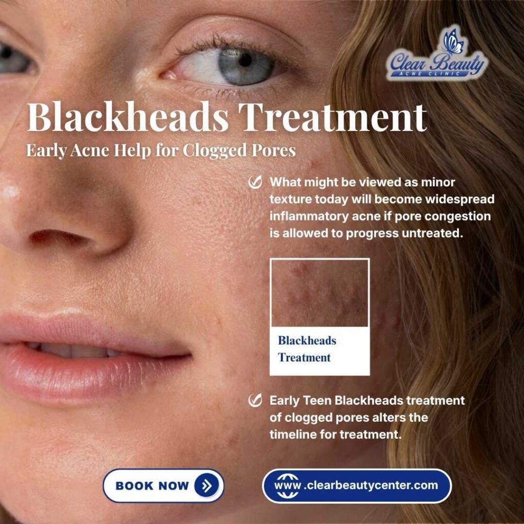 Stop Breakouts: Teen Blackheads Treatment in Frisco, TX