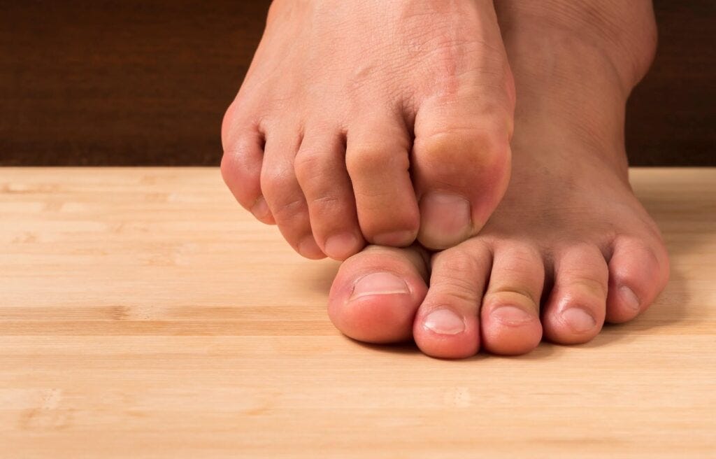 Can wearing socks cause foot fungus ? | by Kamal Kishore Singh | Medium