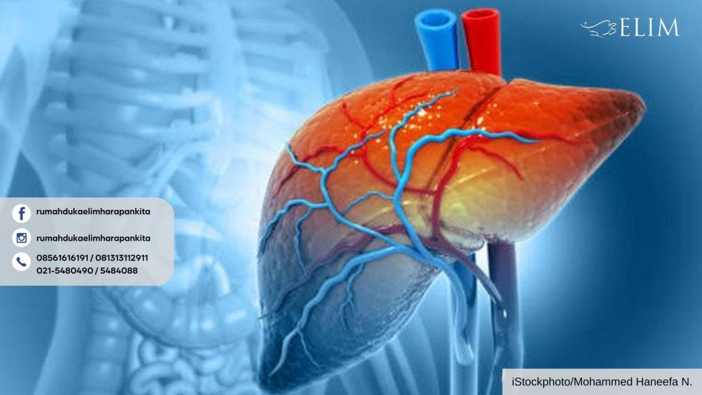 Waspada Hepatitis C, Ini Gejalanya