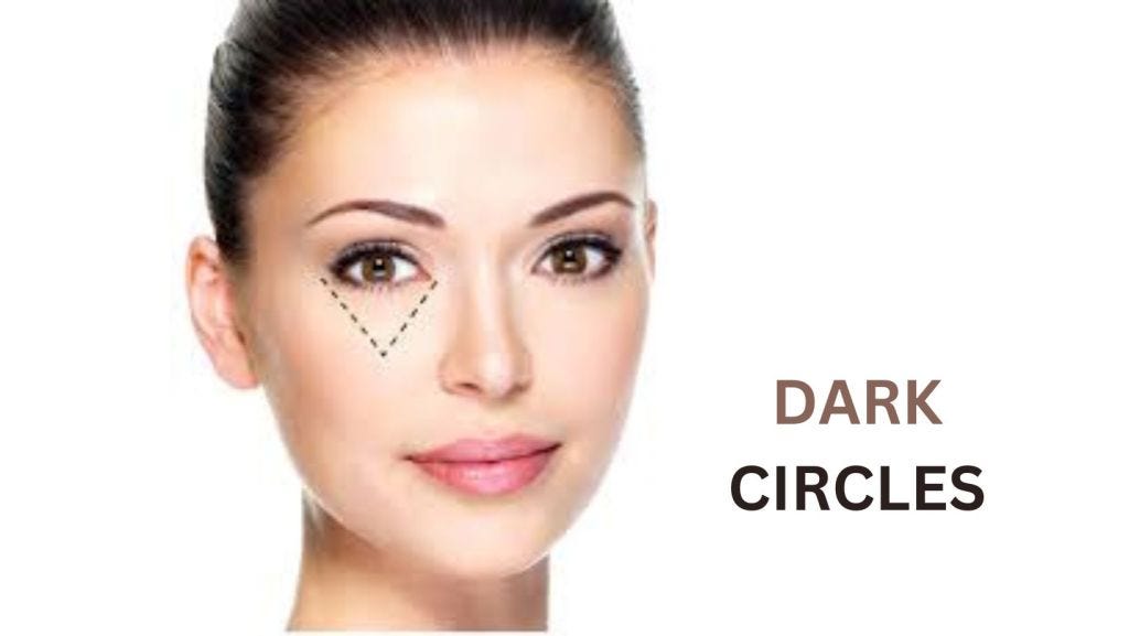 Remove Dark Circles Step By Step. Removing dark circles permanently can