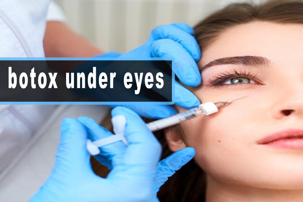 Mesmerizing Can You Get Botox Under Your Eyes Photo Art Mesmerizing Can You Get Botox Under Your Eyes Photo Art