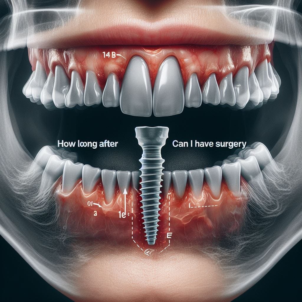 HOW LONG AFTER DENTAL WORK CAN I HAVE SURGERY by Elitedentalmiami