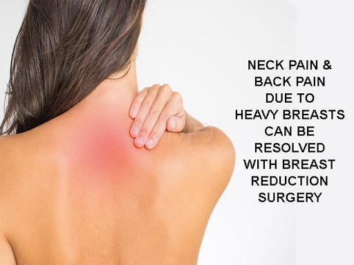 Heavy Breasts Are Causing Neck or Back Ache