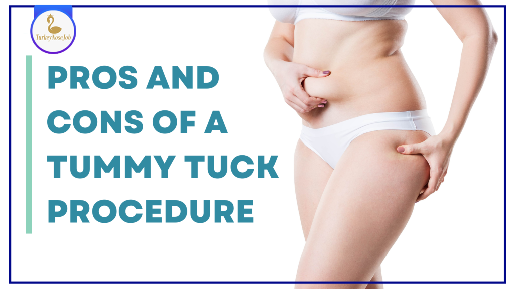 Tummy Tuck6 Most Important Things to Know About a Tummy Tuck, by  Turkeynosejob Com