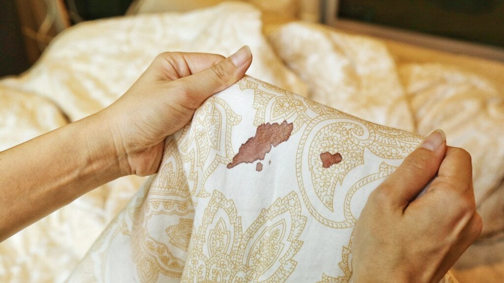 How To Remove Blood Stain From Bedsheet by Customized Bedsheet Medium
