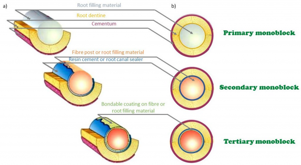 Dental and Endodontic Filling Materials and Methods by Scot Thom Medium