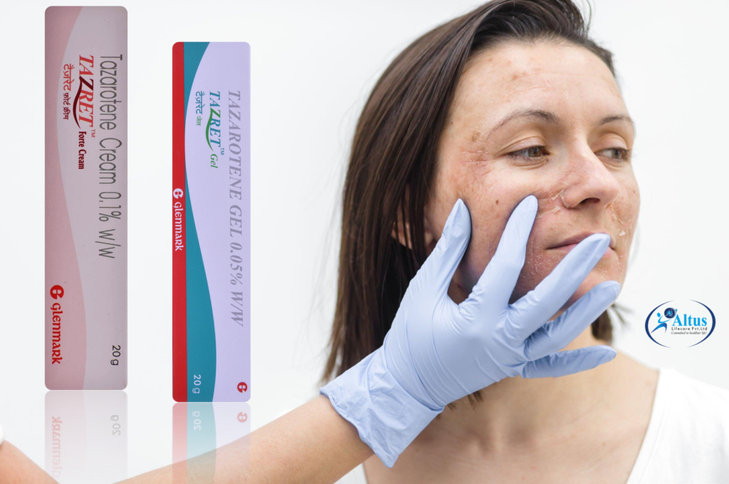 Say Goodbye to Wrinkles with Tazarotene Cream — Real Results Unveiled