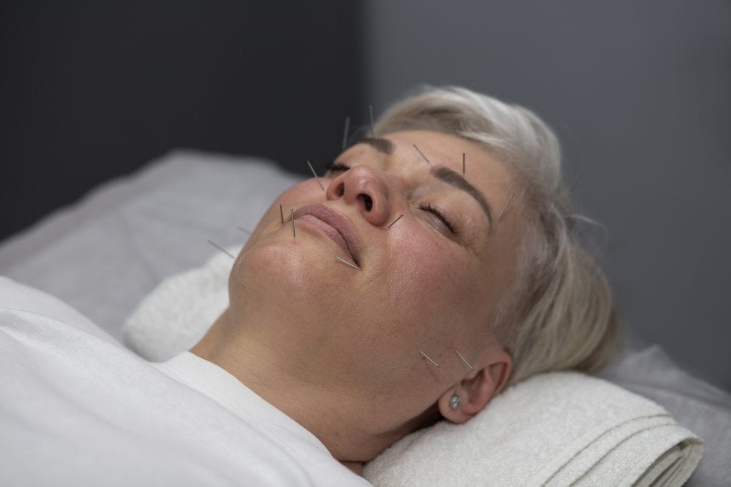 Unlocking Youthful Radiance: The Comprehensive Guide to Facelift Acupuncture Training  by 