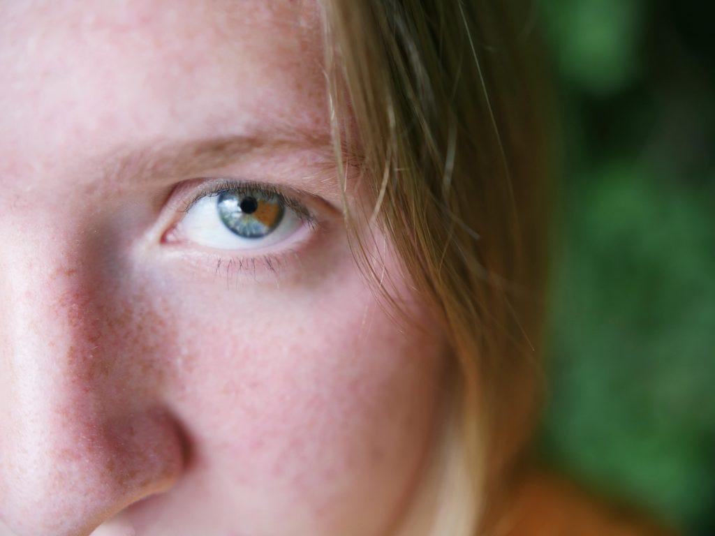 Protecting Your Vision: How B-Vitamins and Retinal Metabolism May Halt Glaucoma