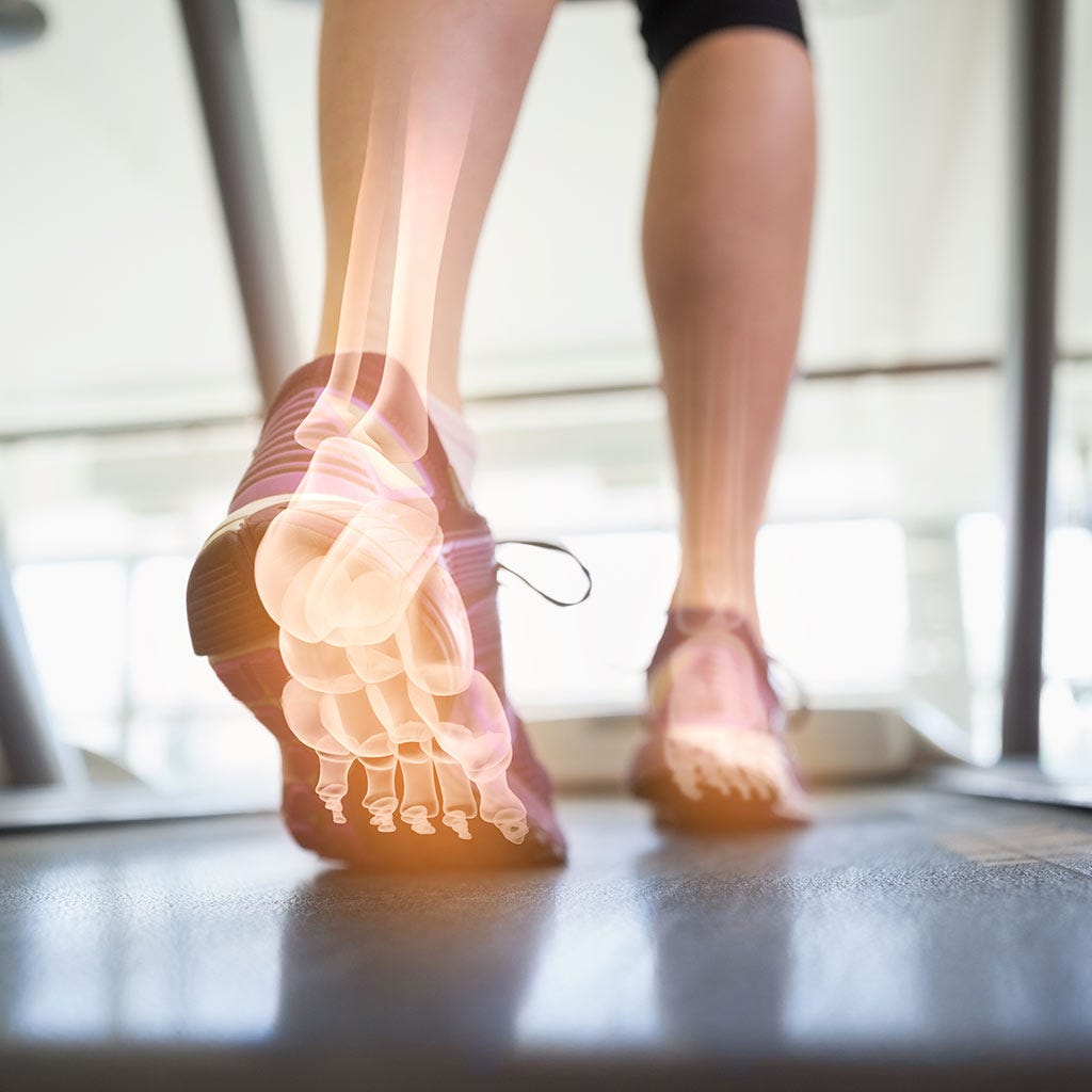 Battling Foot Pain in Barrie: How Custom Orthotics Can Help