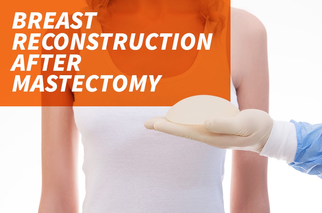 Breast Reconstruction After Mastectomy What to Expect by Oncologist