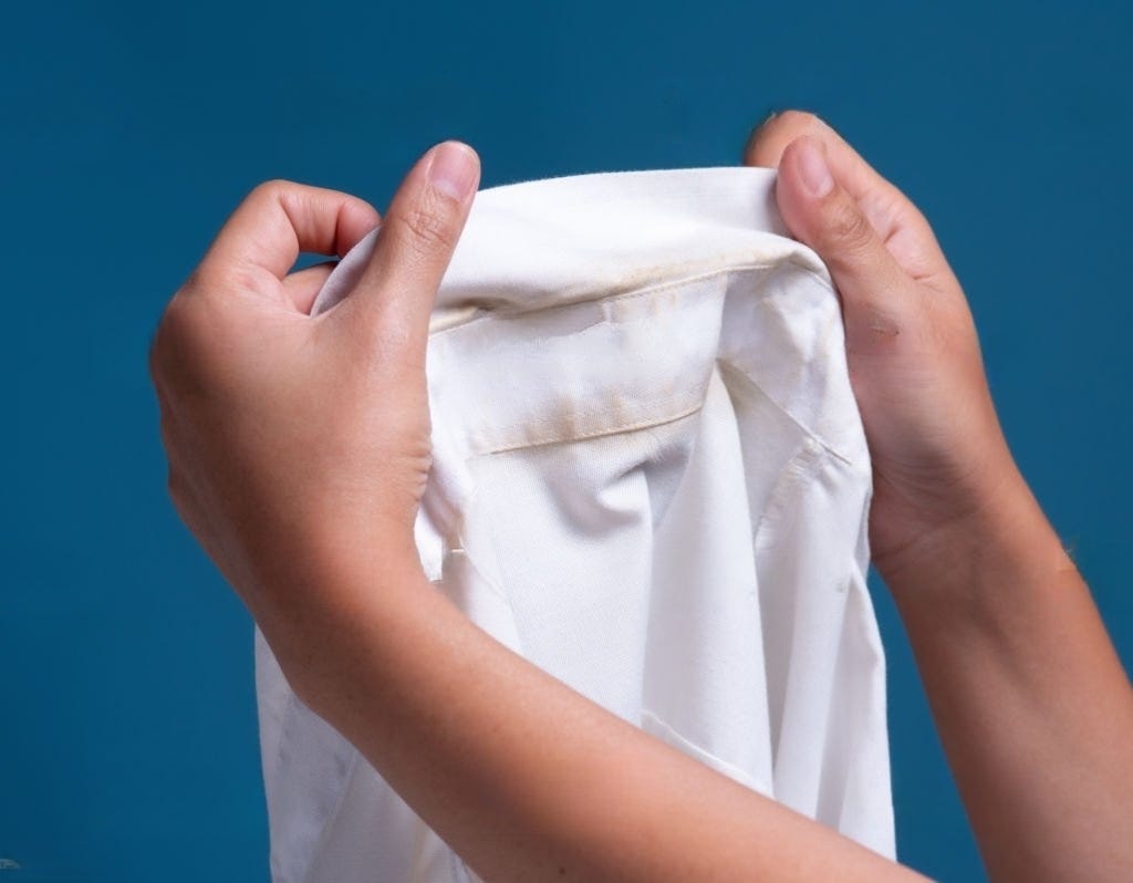 How To Get Rid Of Yellowing On White Clothes at Donna Cosper blog
