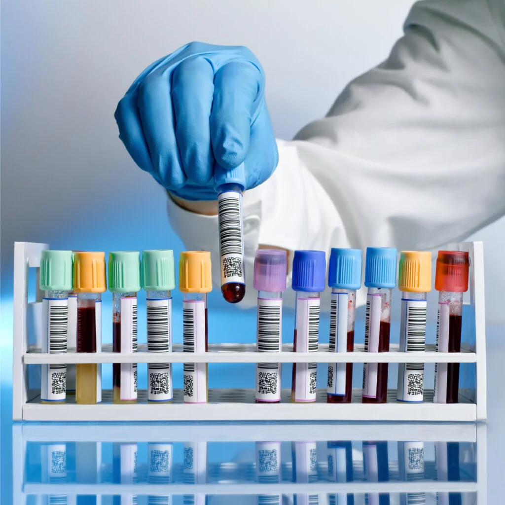 Choosing the Right Blood Biospecimen for Immune Cell Research