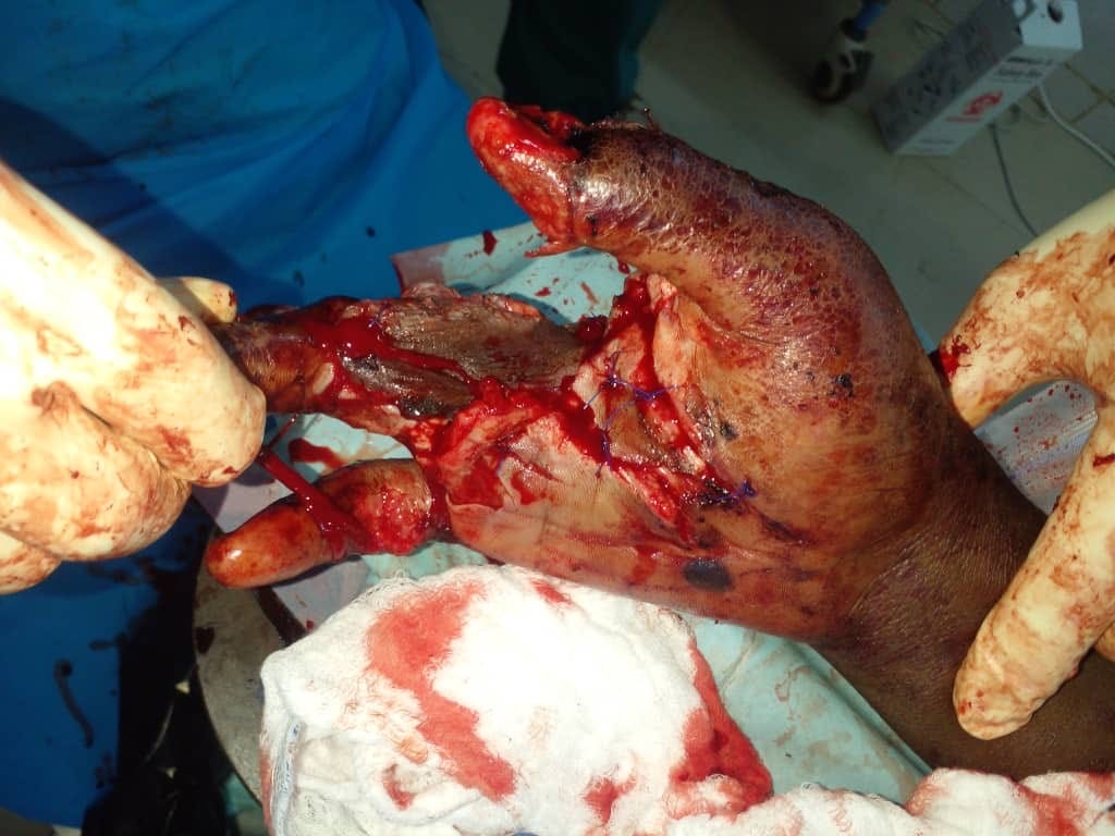 Reflections from a humanitarian surgeon in Sudan part 4