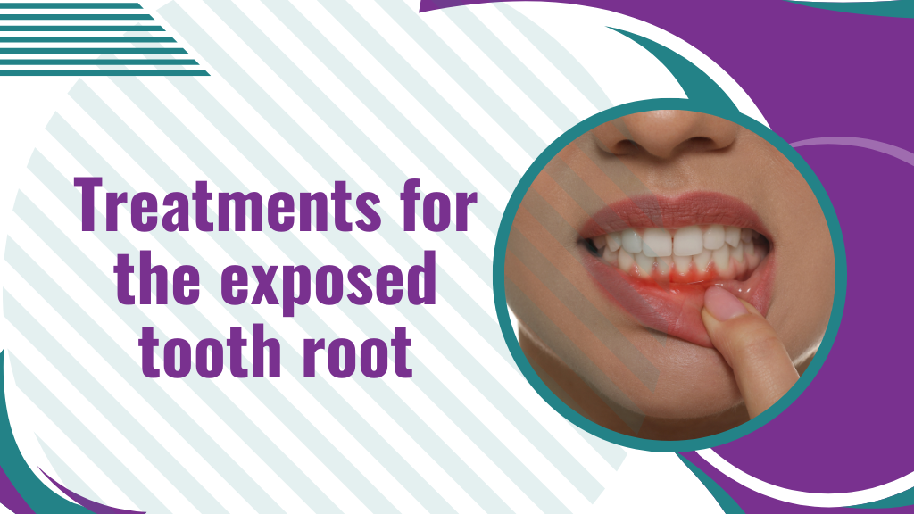 Treatments for the exposed tooth root by Shikhasinha Medium