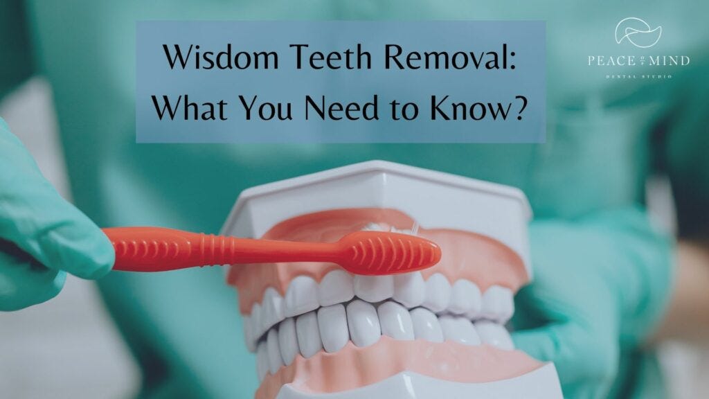 Wisdom Teeth Removal What You Need to Know? by Peace of Mind Dental