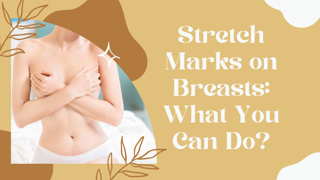 Stretch Marks on Breasts: What You Can Do, by Panto Math