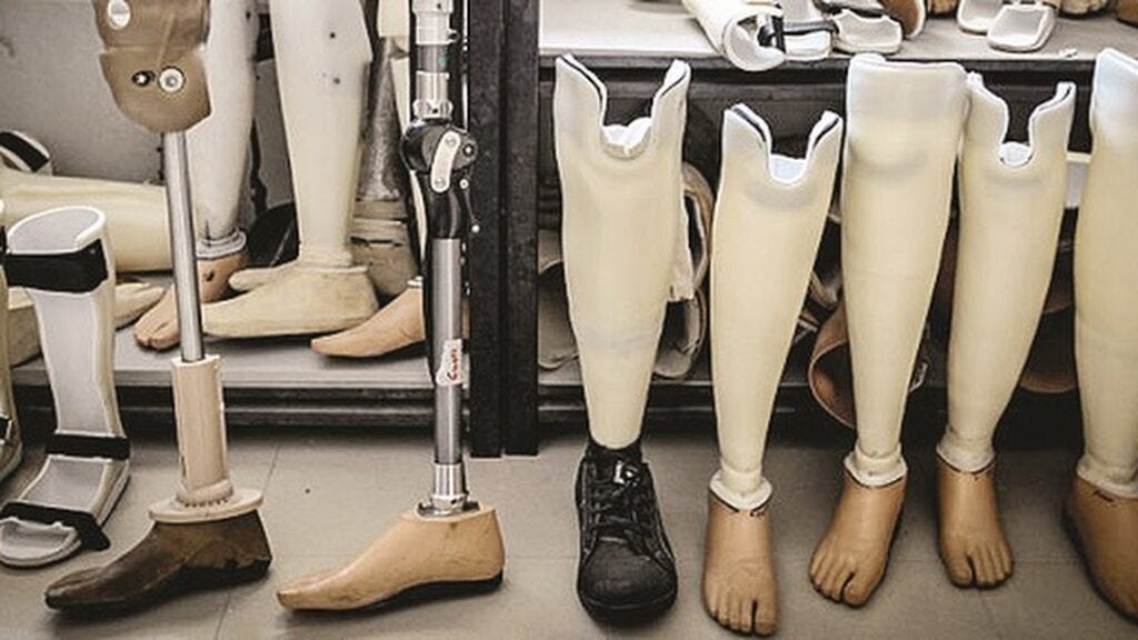 Advancements in Artificial Limbs. Artificial limbs have come a long way ...