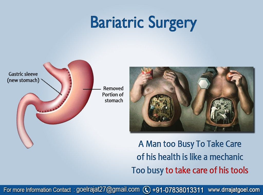 What is Bariatric Surgery? Bariatric surgery popularly known as by
