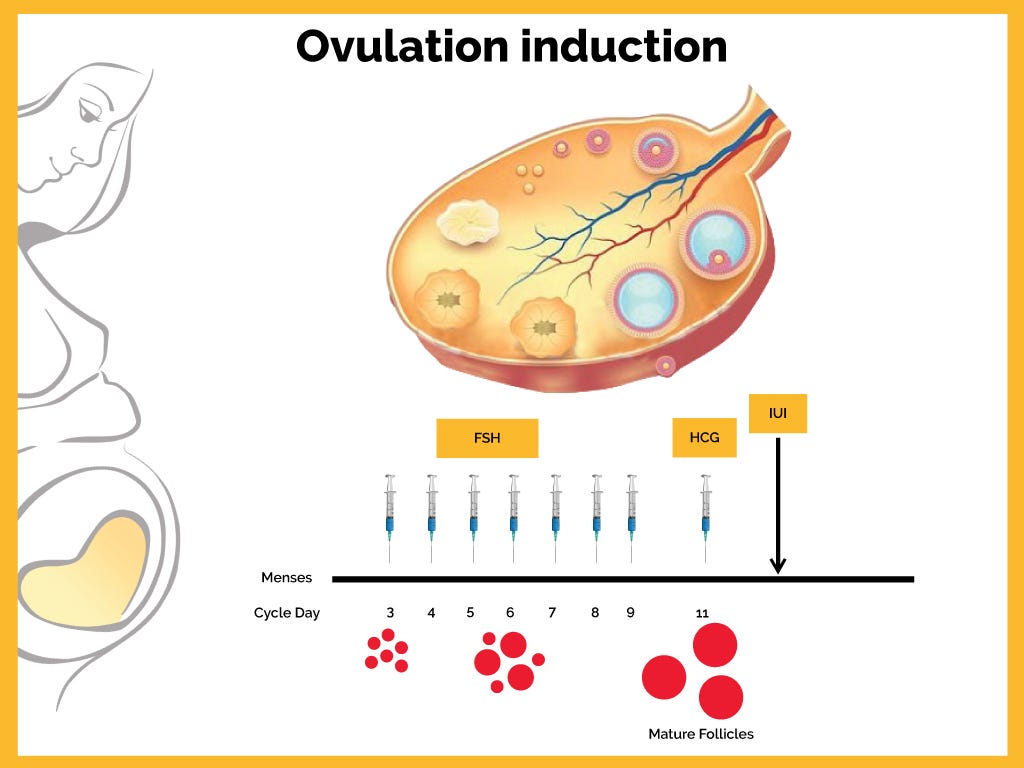 How is Ovulation Induction performed? Drnehalalla Medium