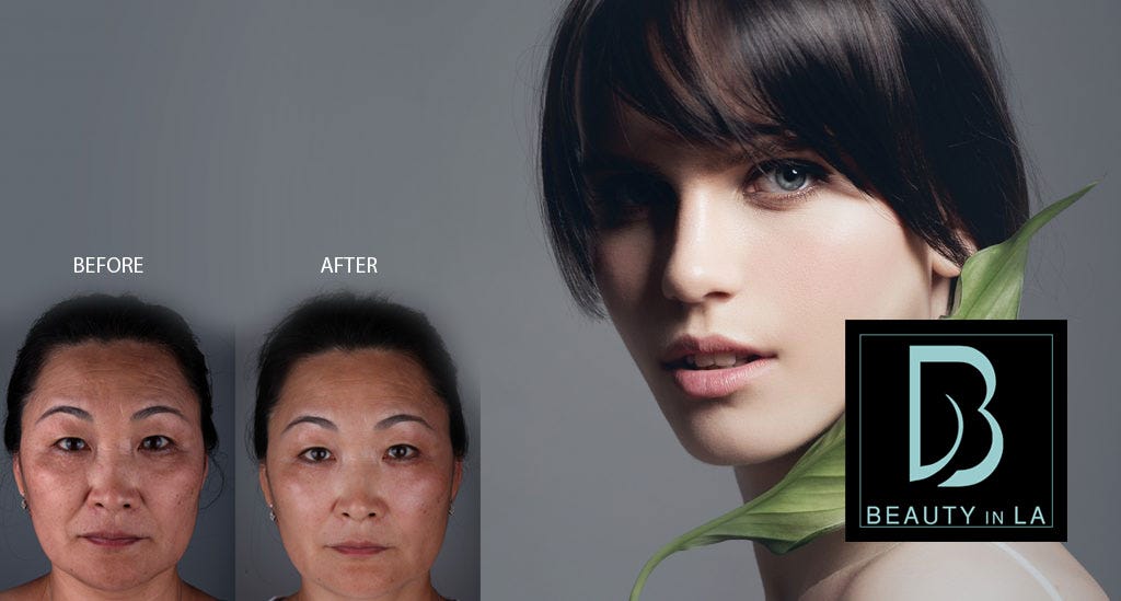 DISCOVER RADIANCE AT BEAUTY IN LA CLINIC: WHERE EXCELLENCE MEETS COMPASSION