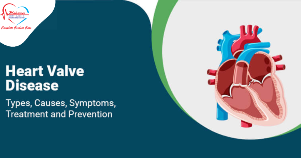 Hear Signs and Symptoms of Heart Valve Disease — Heart Specialist by