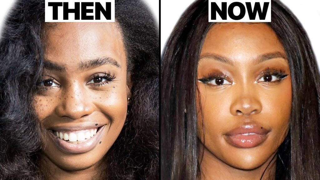 SZA Before Plastic Surgery. Introduction, by Surgical Tech