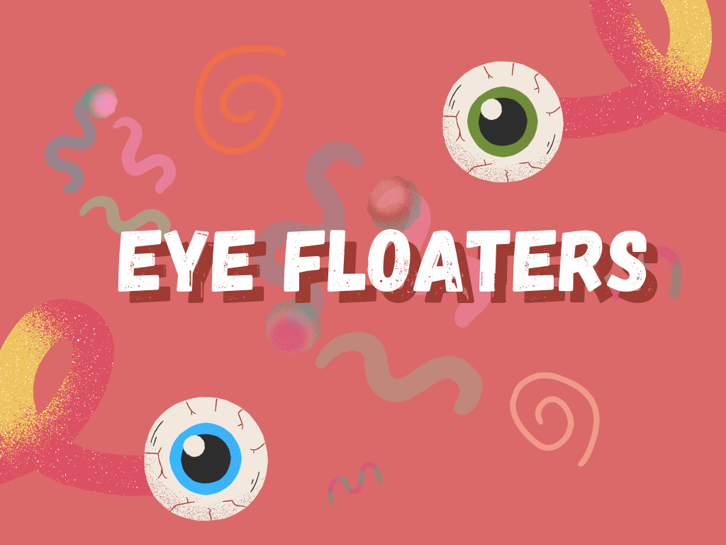 Eye Floaters Those Tiny Spots and Squiggly Lines in Front of Your