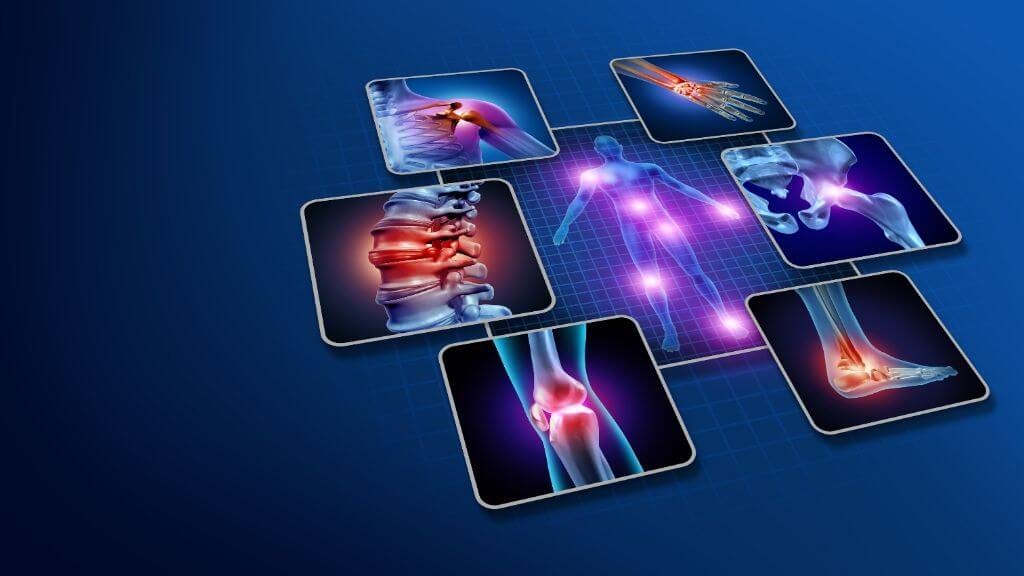 The Dangers of Glucosamine and Chondroitin & What You Should Be Taking