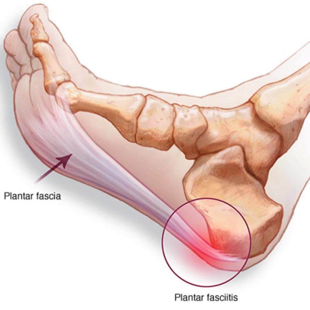 Before you purchase women’s planter slippers with arch support, it would be nice if I told you a…