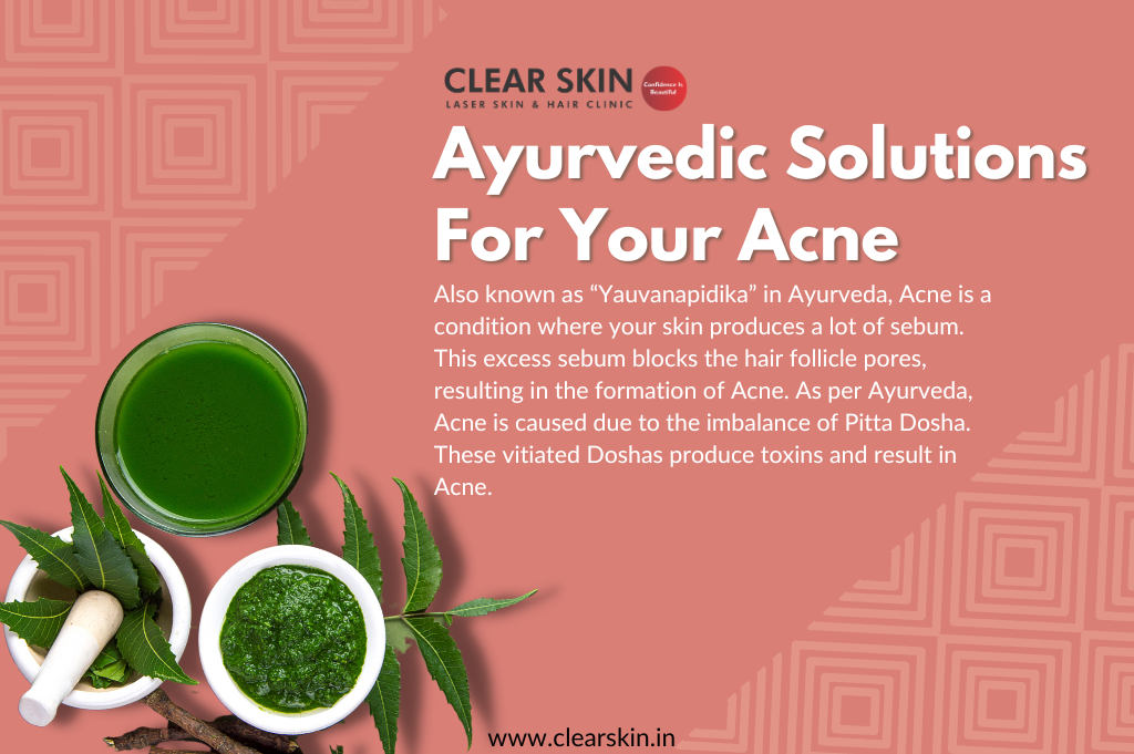 Ayurveda and Acne, How it Works?. Ayurveda, an ancient Indian science… by ClearSkin Laser Skin
