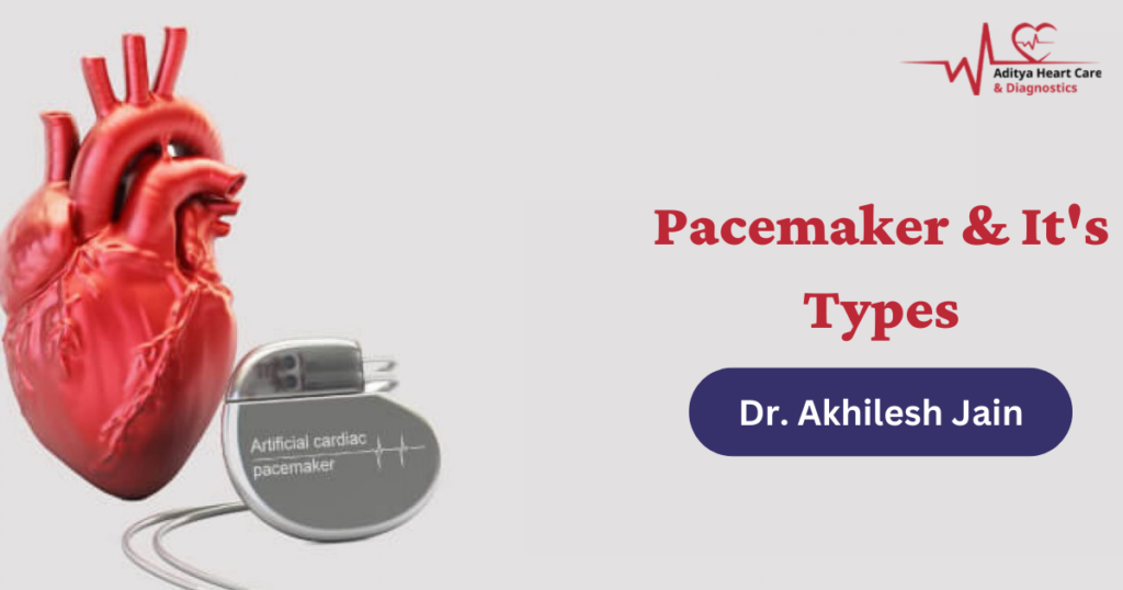 How Does A Pacemaker Work — Heart Specialist Doctor in Indore by