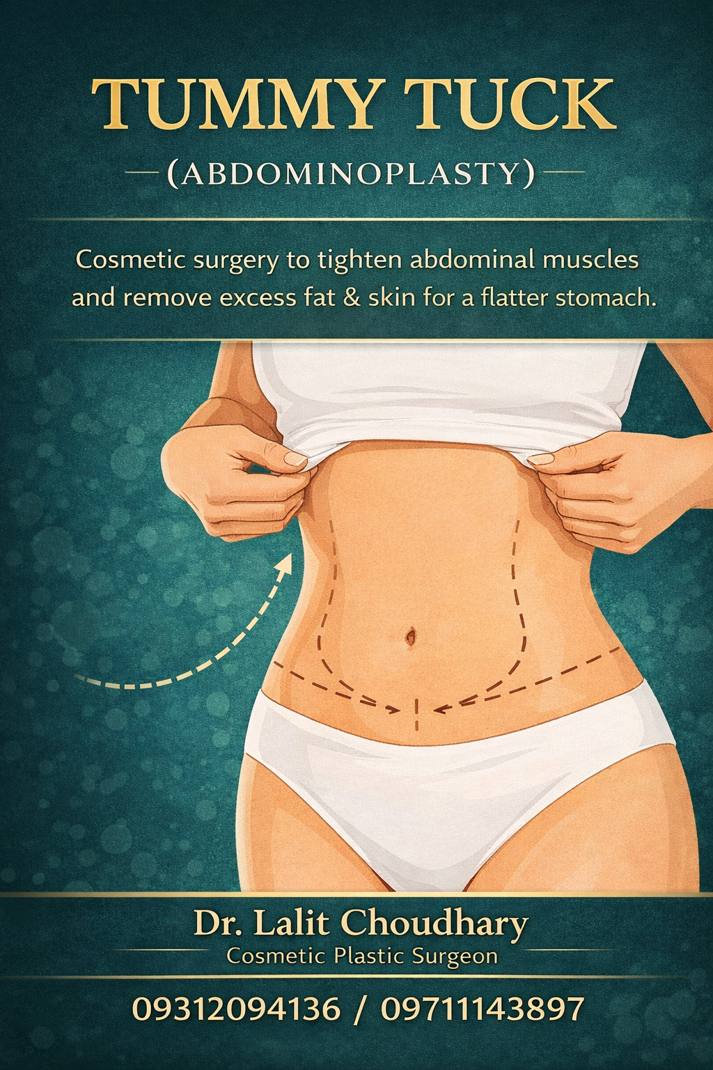 Liposuction vs Tummy Tuck: Which Procedure is Right for You?