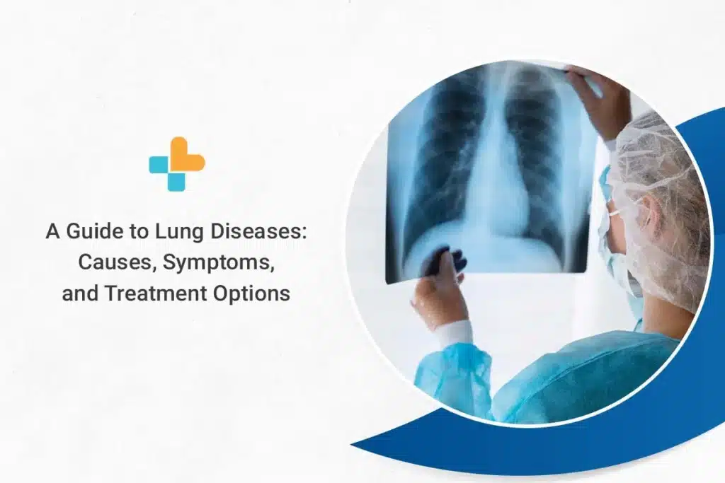 A Guide to Lung Diseases Causes, Symptoms, and Treatment Options by