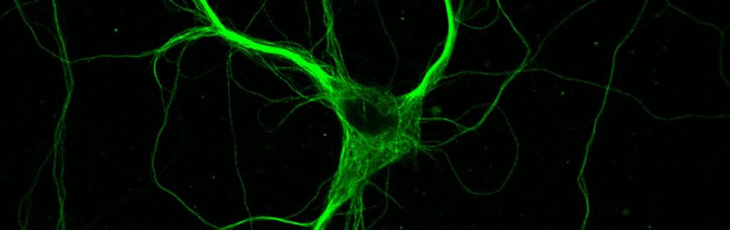 Unlocking the molecular mechanisms behind Alzheimer’s disease